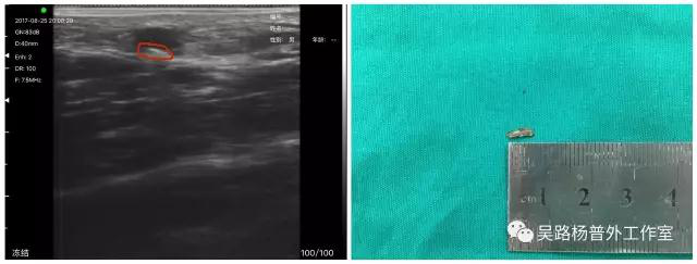 1642585008103273.png 图片6.png