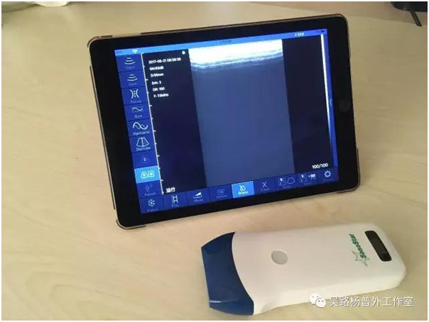 逆天了，这位外科医生配有“透视眼”！