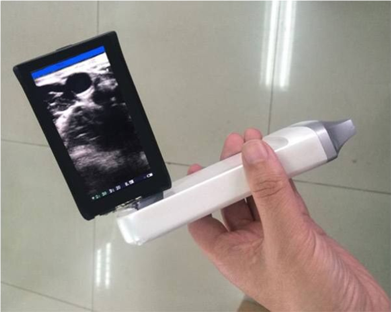 这个新生代掌上B超仪器是如何颠覆传统产品的！