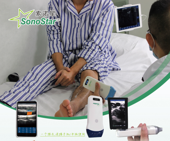 Wireless Palm Ultrasound Used in MSK