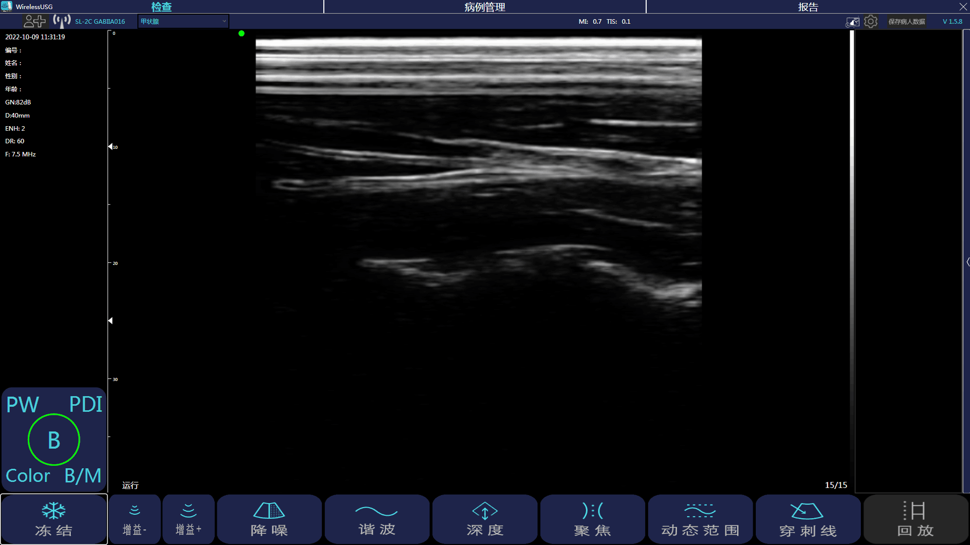 WirelessUSG Windows APP