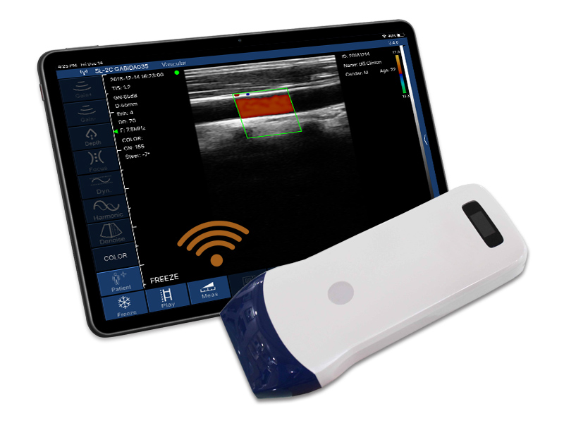 5L linear palm doppler ultrasound scanner