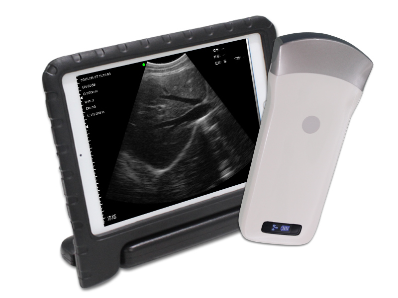 3C标配凸阵无线探头式掌上黑白超