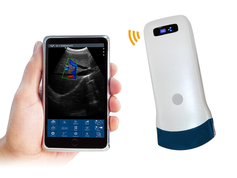 5C convex palm doppler ultrasound scanner