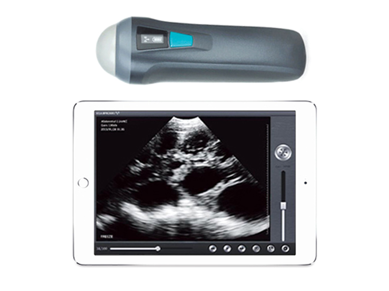 VProbe-1 Wireless Probe Ultrasound Scanner