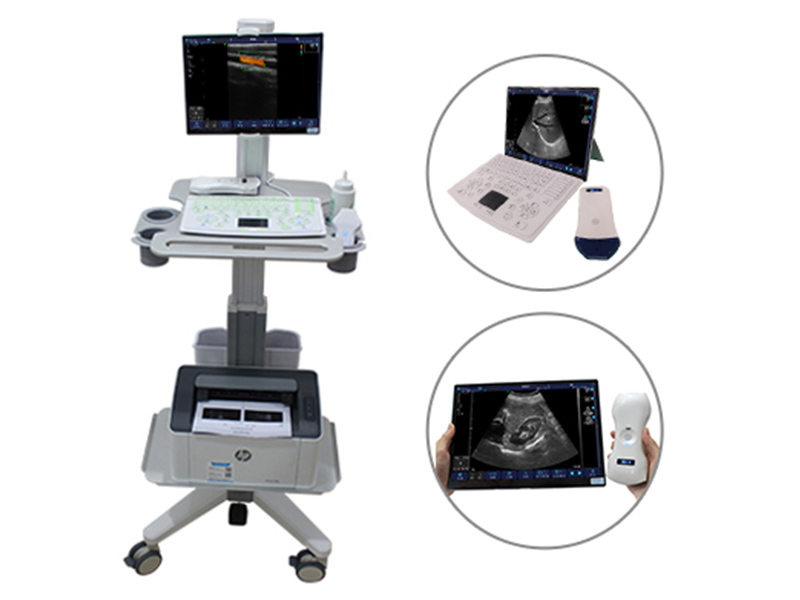 T3 Trolley/Portable/Handheld 3 in 1 Color Doppler Ultrasound