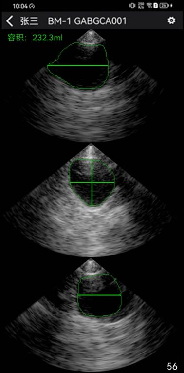 2023050715569821.jpg Q8UFIKX2R17`GW4QPEJ1X40.jpg