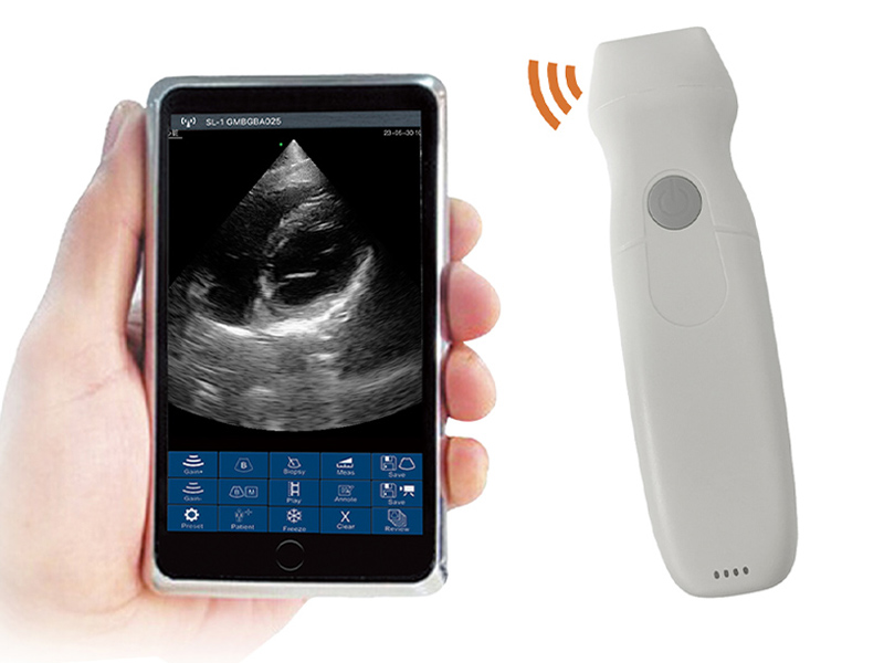 5PA phased array palm doppler ultrasound scanner(with CW)