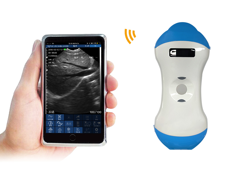5MN 2in1 palm doppler ultrasound scanner