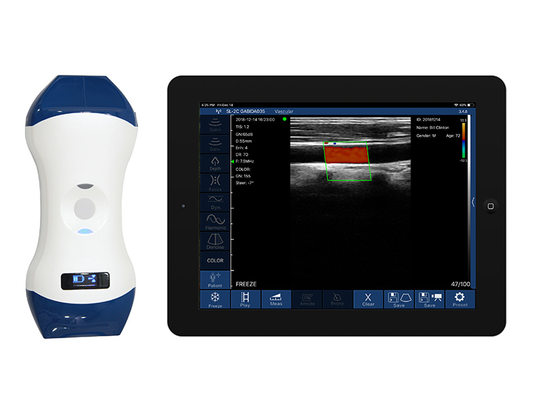 5LP 2in1 palm doppler ultrasound scanner