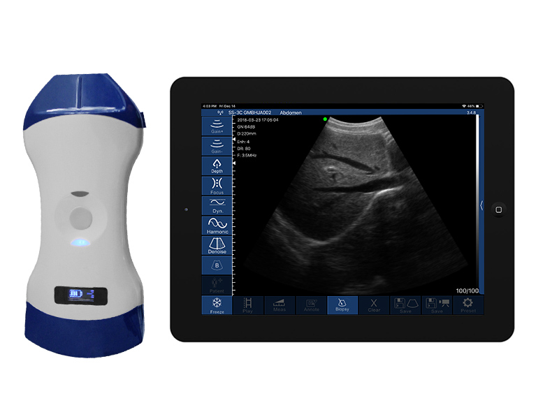 5CP 2in1 palm doppler ultrasound scanner