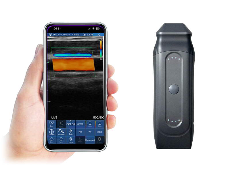 4HL 2in1 palm doppler ultrasound scanner