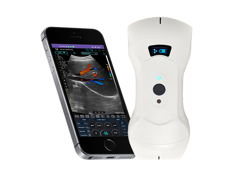 7CPL 3in1 palm doppler ultrasound scanner(VIP Exclusive)