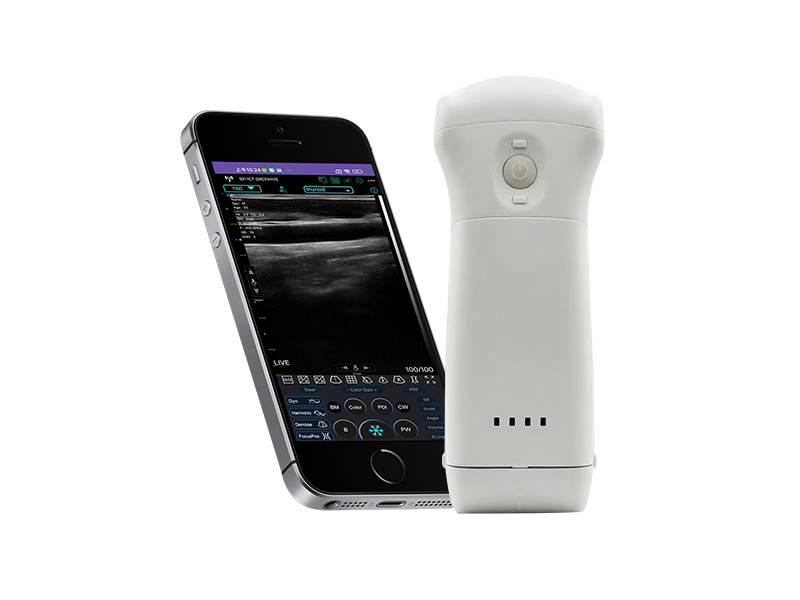 9CPL Replaceable Battery 3in1 palm doppler ultrasound scanner(VIP Exclusive)