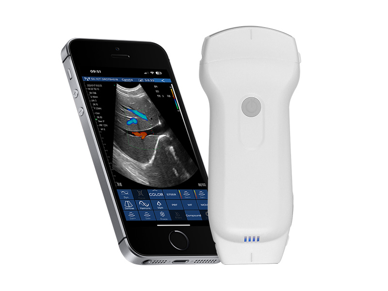4CPL 3in1 palm doppler ultrasound scanner
